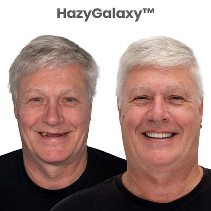 ⏰ HazyGalaxy™ Custom-Fit Dentures  ENDS TODAY   70% OFF | Smile with Confidence