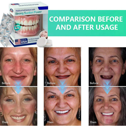 🌎Ends Today: 70% OFF! ⏰ Medical Full Denture with Strong Suctiond