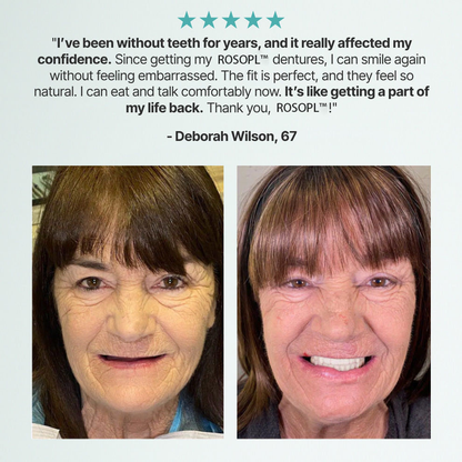 🔥🔥🔥Ends Today: 70% OFF!🦷DarkFairy™ Custom-Fit Full Functional Dentures Make you more confident